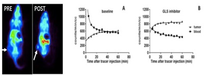Measuring changes in glutamine metabolism  after glutaminase inhibtion using [18F]fljuoroglutamine